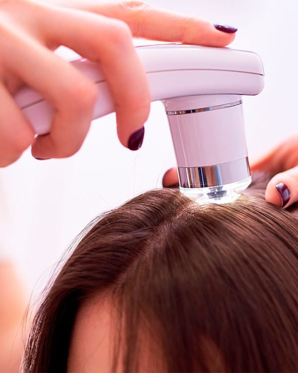 diagnostico-capilar-sevilla